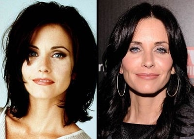 A picture of Courteney Cox before (left) and after (right) plastic surgeries.